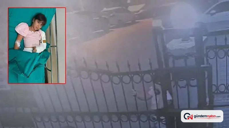 11 yaşındaki çocuğun kolu sürgülü kapıya sıkışıp kırıldı