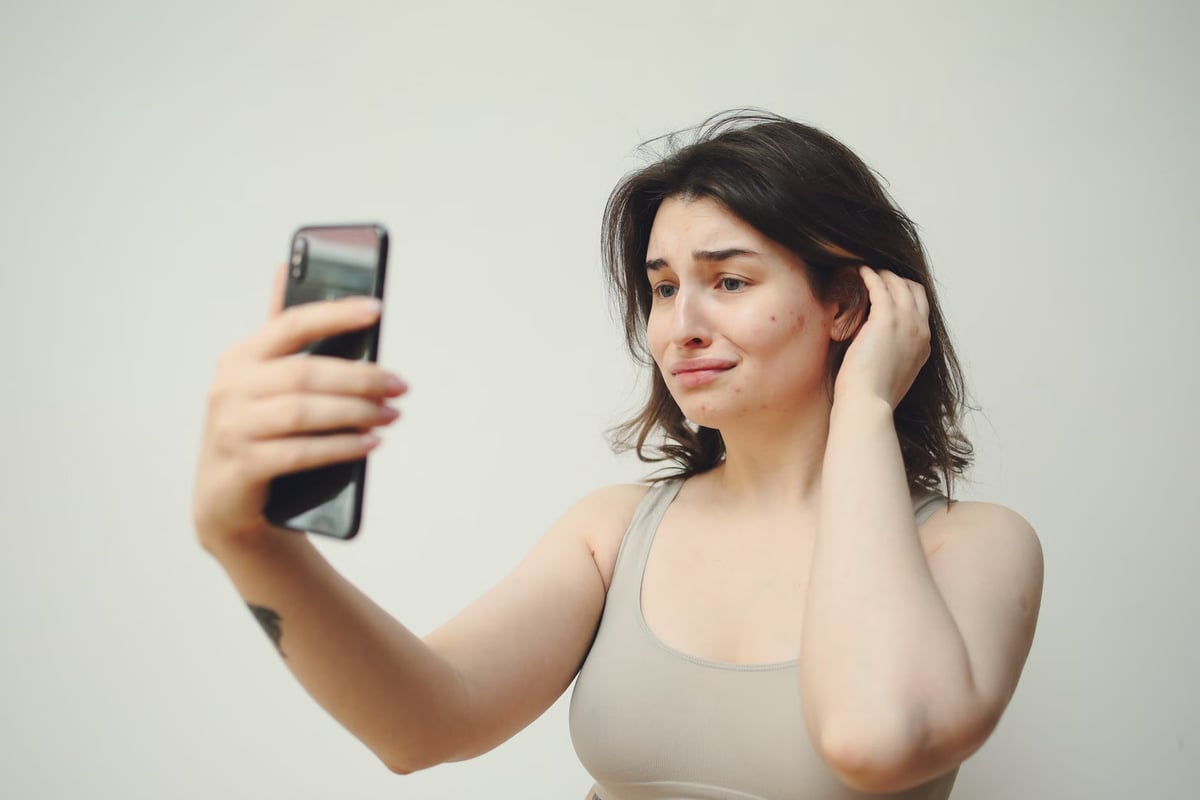 Kirli telefon ekranı akneyi tetikliyor