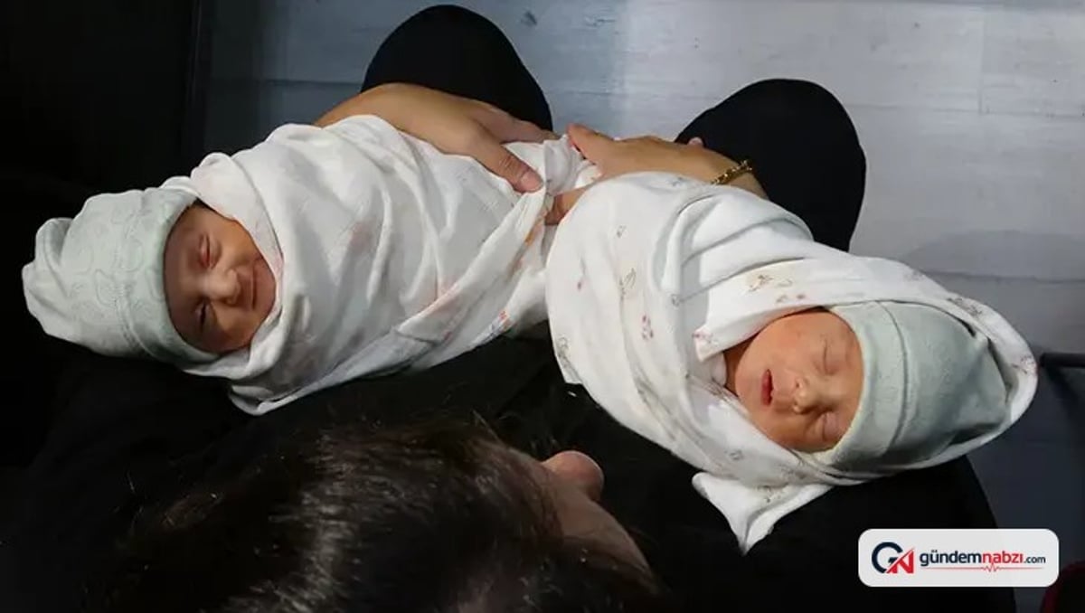 Trabzon'da nadir görülen gebelikle iki bebek dünyaya geldi