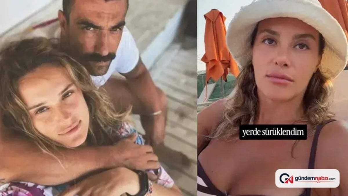 İbrahim Çelikkol'un eski eşi Mihre Mutlu'ya köpek saldırdı