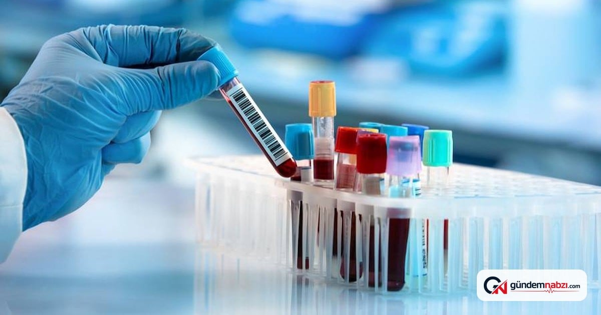Roche'un Alzheimer kan testine FDA'den onay çıktı