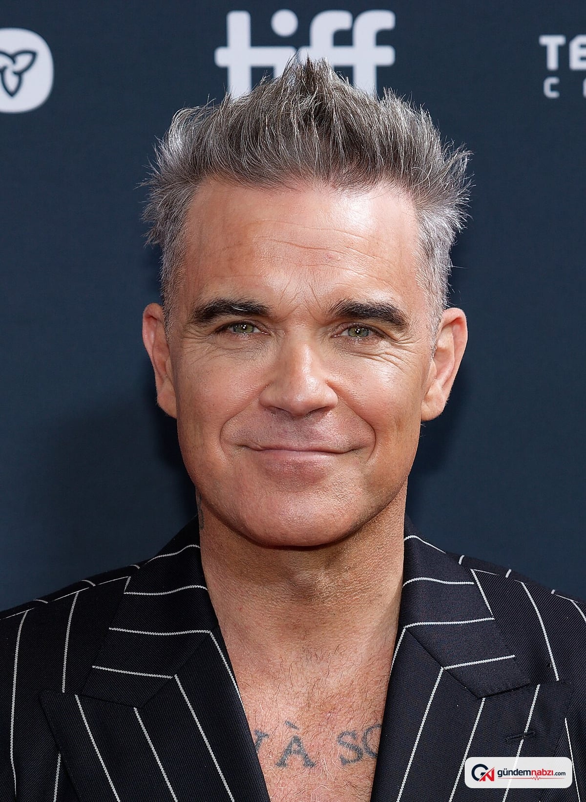 Robbie Williams'a otizm teşhisi konuldu