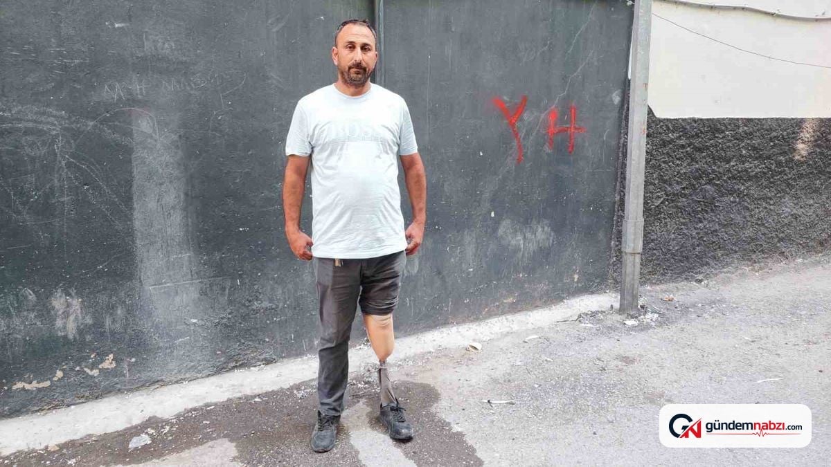 Protez bacaklı temizlik görevlisi 700 lira alacak yüzünden işten oldu