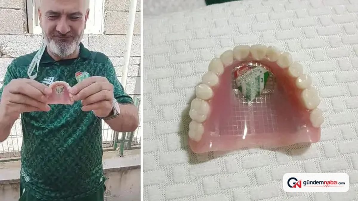 Bursaspor taraftarı takma dişinin damağına kulüp amblemi yaptırdı