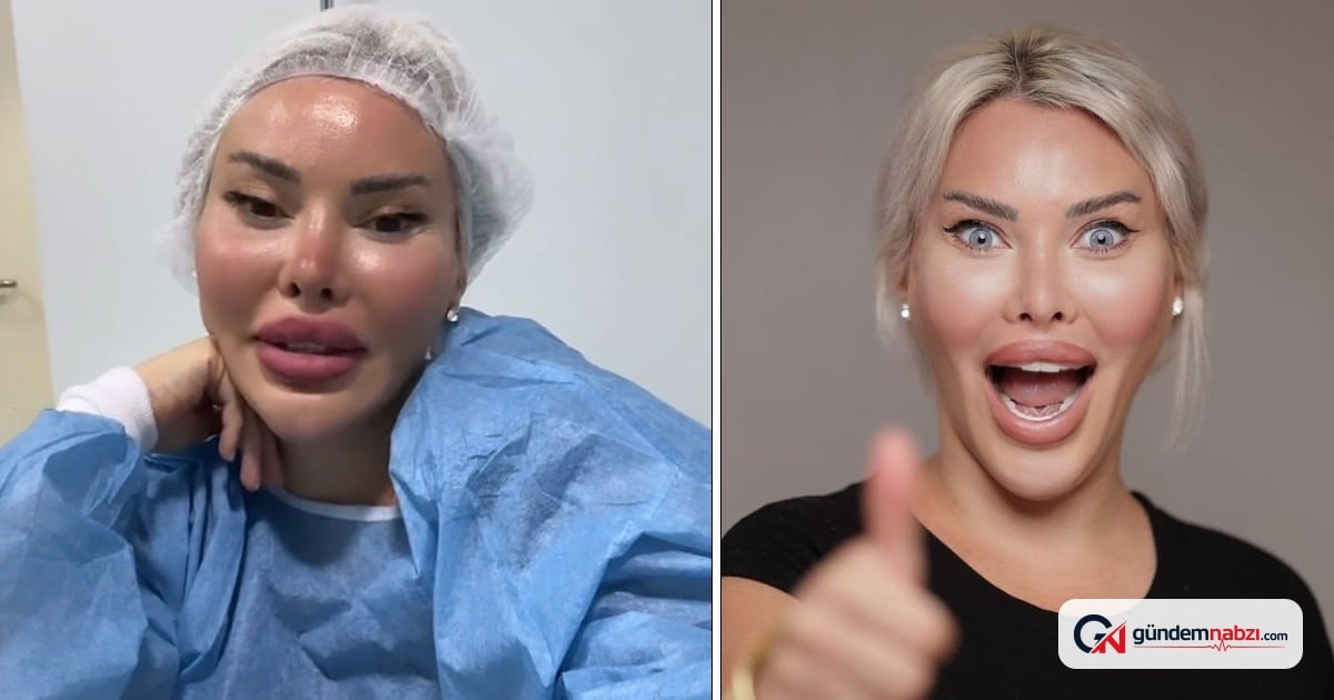 Pınar Özkurteller göz rengini değiştirdi