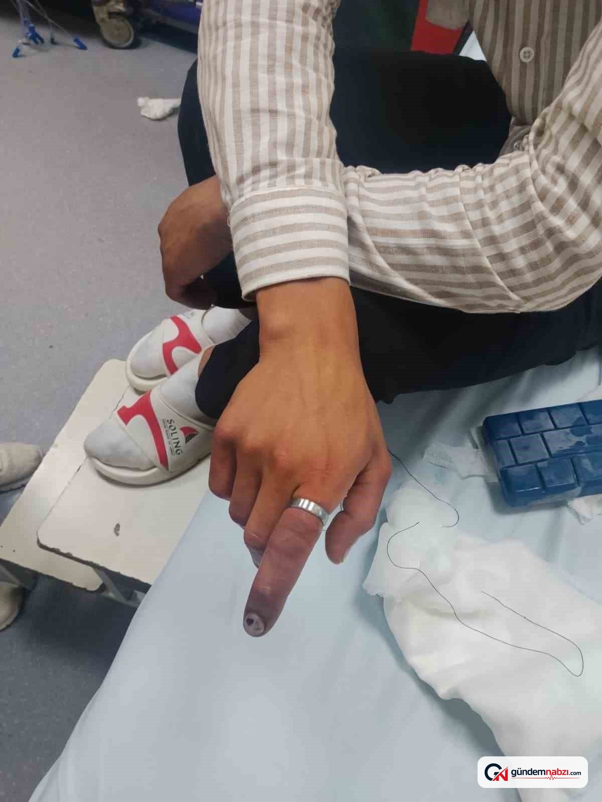 Bitlis'te parmağında sıkışan yüzük itfaiye ekiplerince kesildi