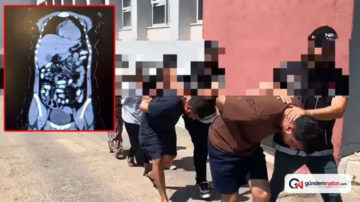 Adana'da midesinde 1,5 kilo metamfetamin bulunan 2 kurye tutuklandı