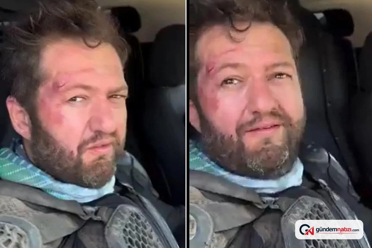 Fenomen Ömer Başdoğan motosiklet kazası geçirdi