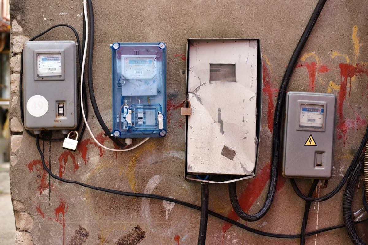 Elektrik kofrasındaki patlama: Elanur 10 yılda 20 kez ameliyat oldu