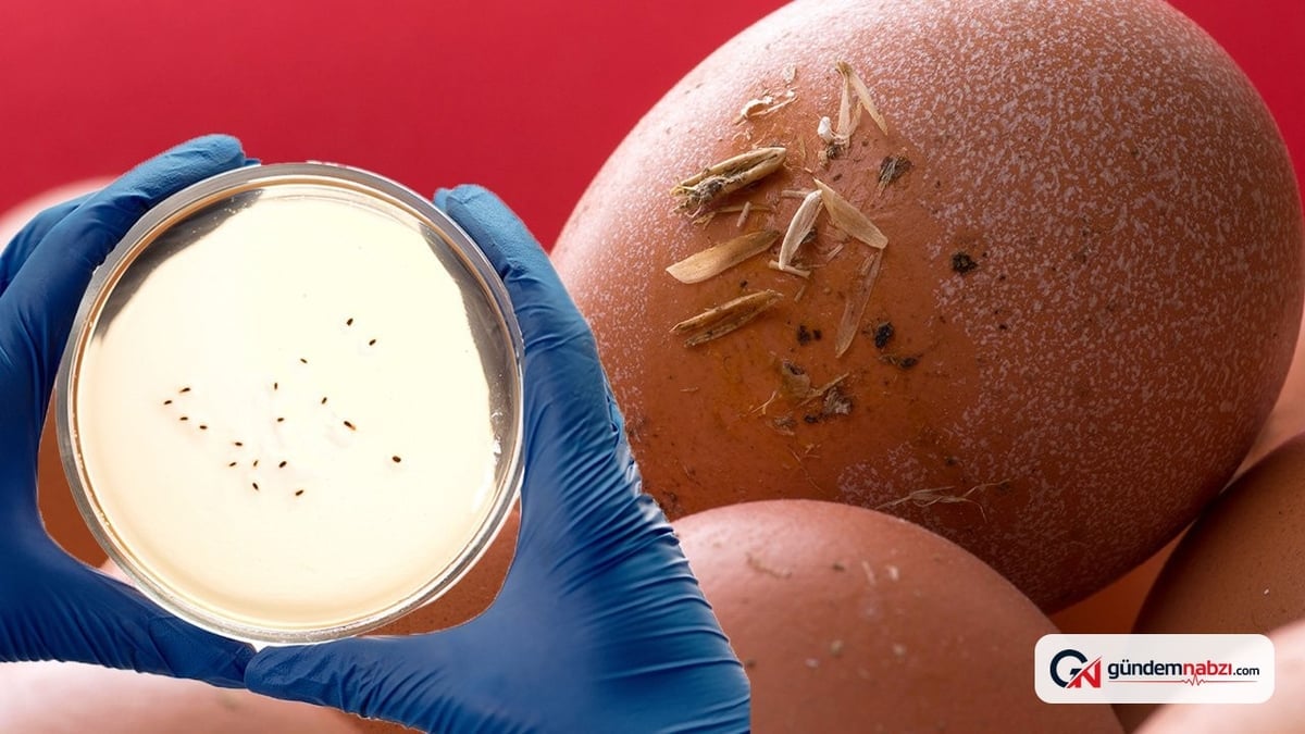 Salmonella salgınında vaka sayısı 318'e yükseldi