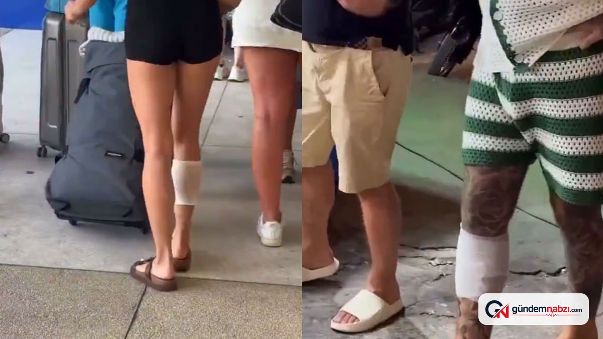 Tayland'a giden turistlerin sağ bacağındaki izin sırrı