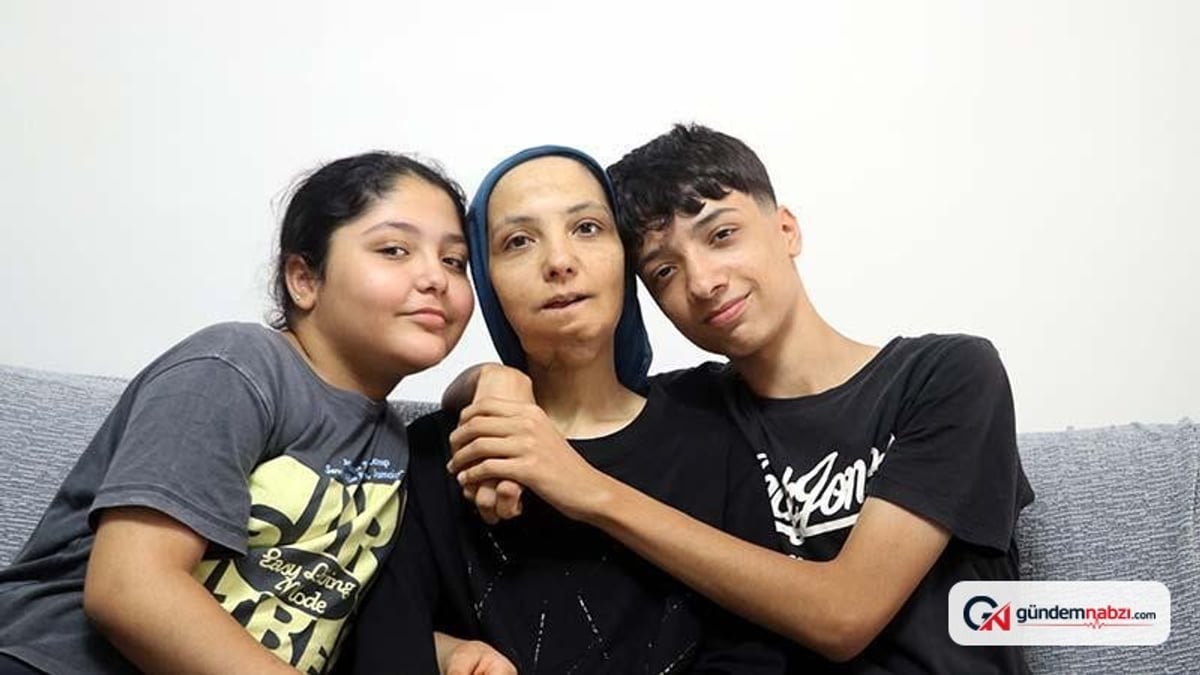 35 ameliyat geçiren kanser hastası kadından yardım çağrısı