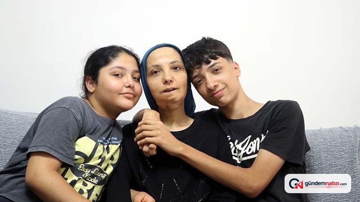35 ameliyat geçiren kanser hastası kadından yardım çağrısı