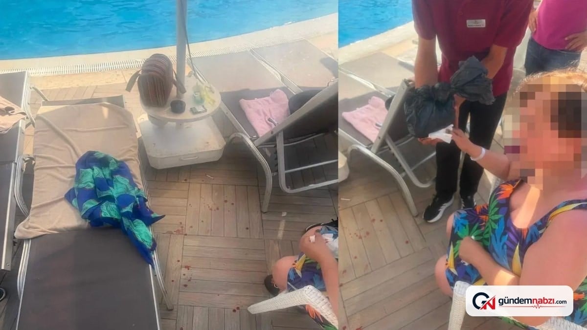 Muğla'da şezlong kazası: Kadının parmağı koptu