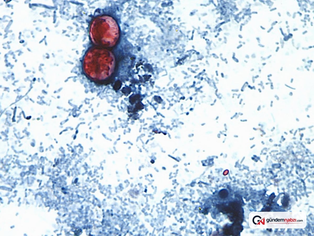 ABD'de ilk cyclospora kaynaklı iki ölüm kayda geçti