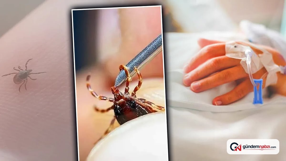 Ordu'da kene ısırığı nedeniyle 35 yaşındaki kadın hayatını kaybetti