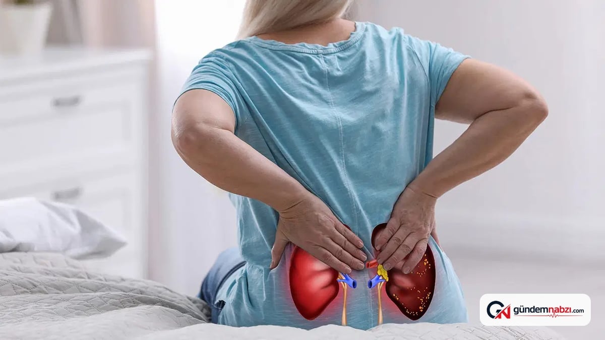 Yaz sıcaklarında artan böbrek taşı riskine karşı uyarı
