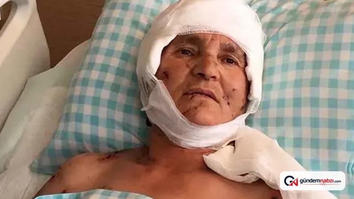 Kırşehir'de köpek saldırısına uğrayan kadına 637 bin lira tazminat