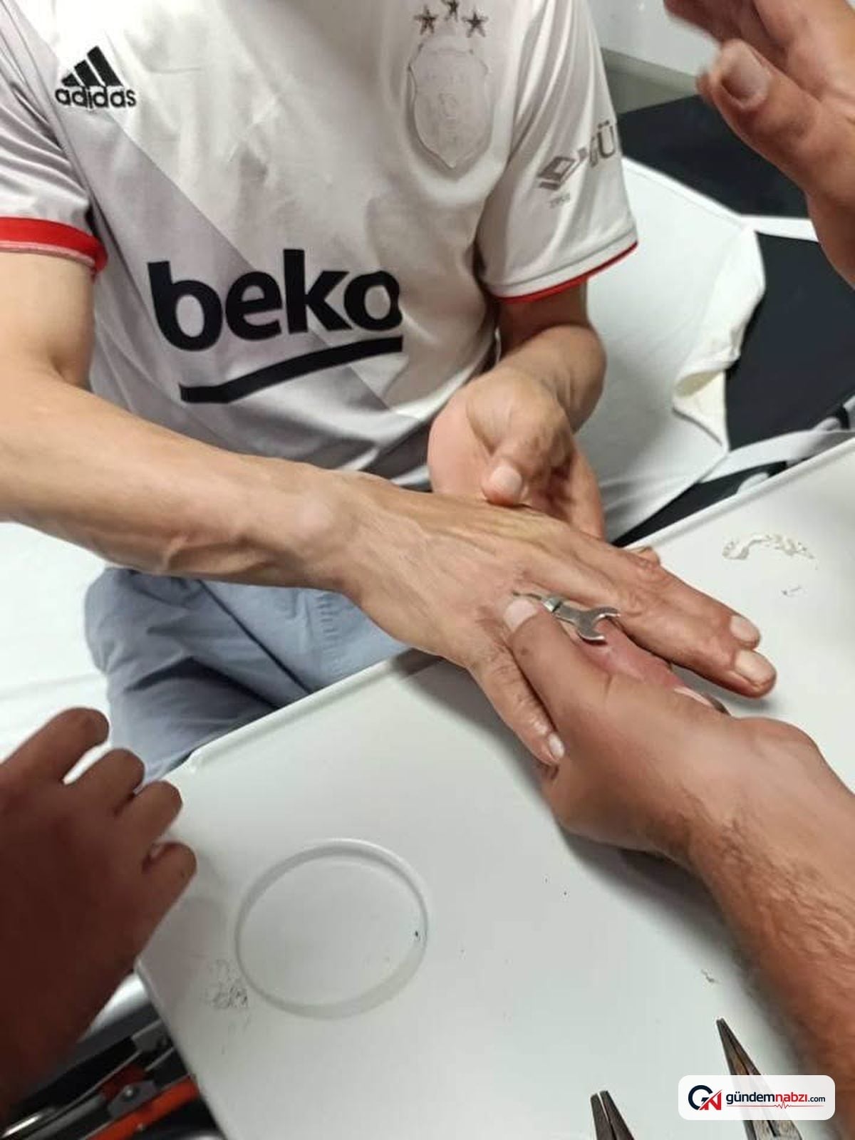 Hatay'da parmağına yüzük sıkışan vatandaş hastanede kurtarıldı