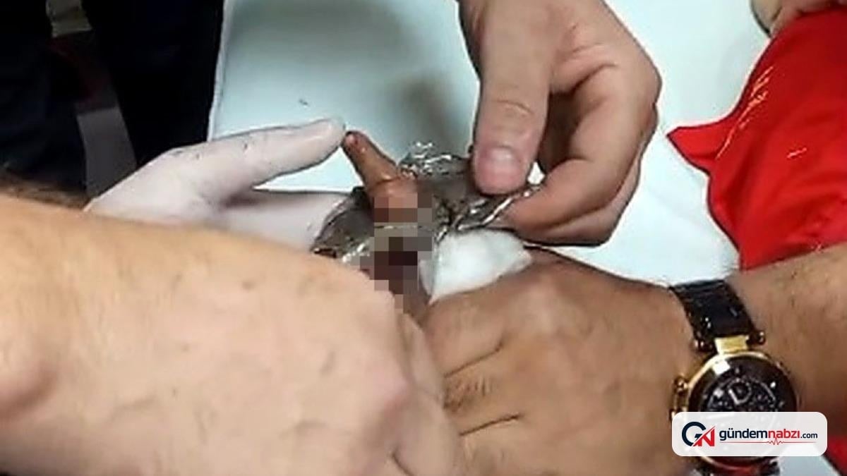 Bitlis'te çelik halkaya parmağı sıkışan çocuk kurtarıldı