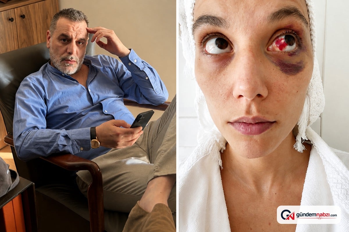 Ozan Güven, eski sevgilisiyle yaşadığı olayın ardından yaşanan süreci anlattı