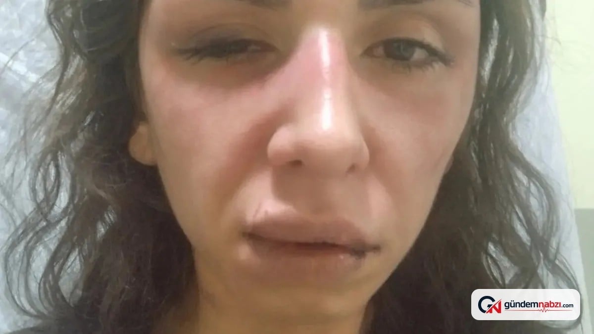 İstanbul Çekmeköy'de eşinden 4 saat işkence gördü