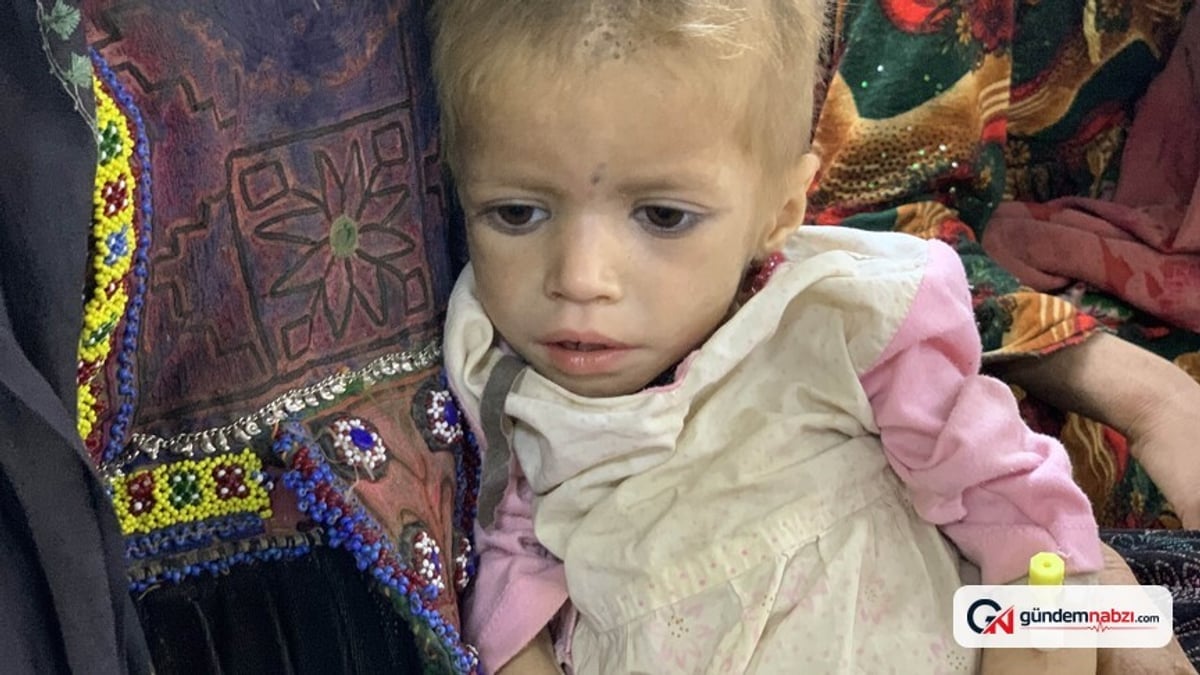 Afganistan'da 3,7 milyon çocuk yetersiz besleniyor