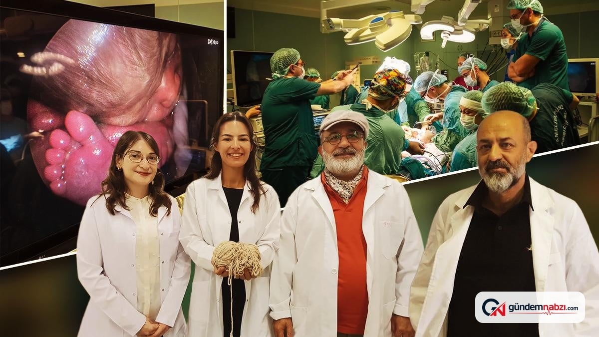 Türkiye'de fetal cerrahi ve iki yeni sağlık projesi