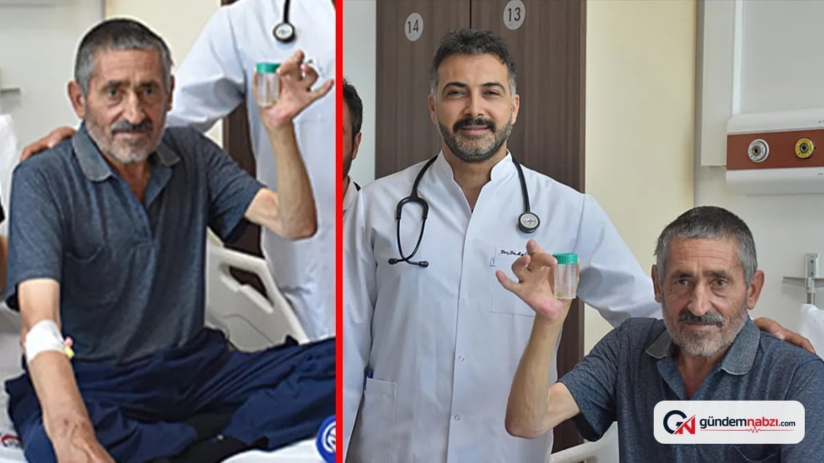 Akciğerinde kitle sanılan şikayetin sebebi sarımsak çıktı