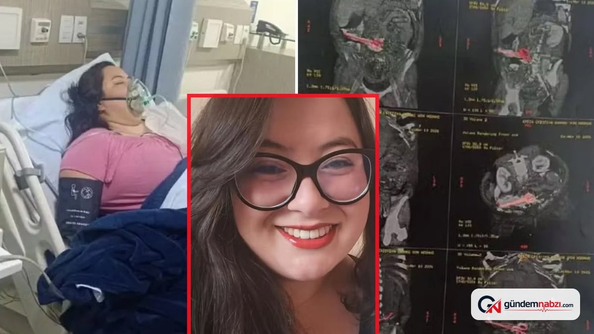 Ameliyatta unutulan makas, kadıncağızın hayatını tehlikeye attı